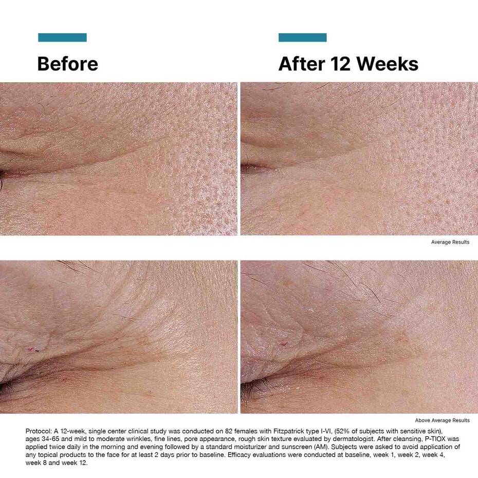 SKINCEUTICALS P-TIOX Peptide serum for expression lines and glass skin radiance