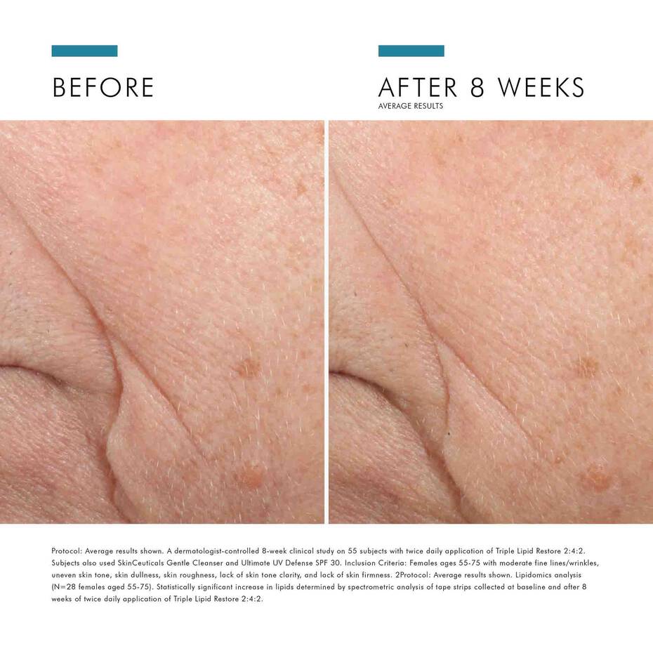 SKINCEUTICALS Triple Lipid Restore 2:4:2 Anti-aging lipid moisturizer cream